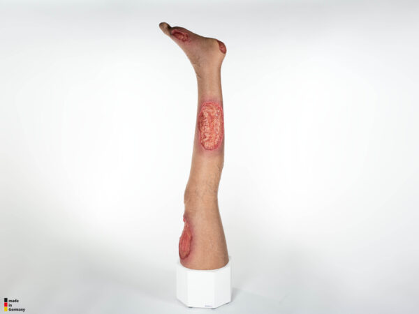 Sockelmodell Bein mit 7 tiefen Wunden – Bild 44