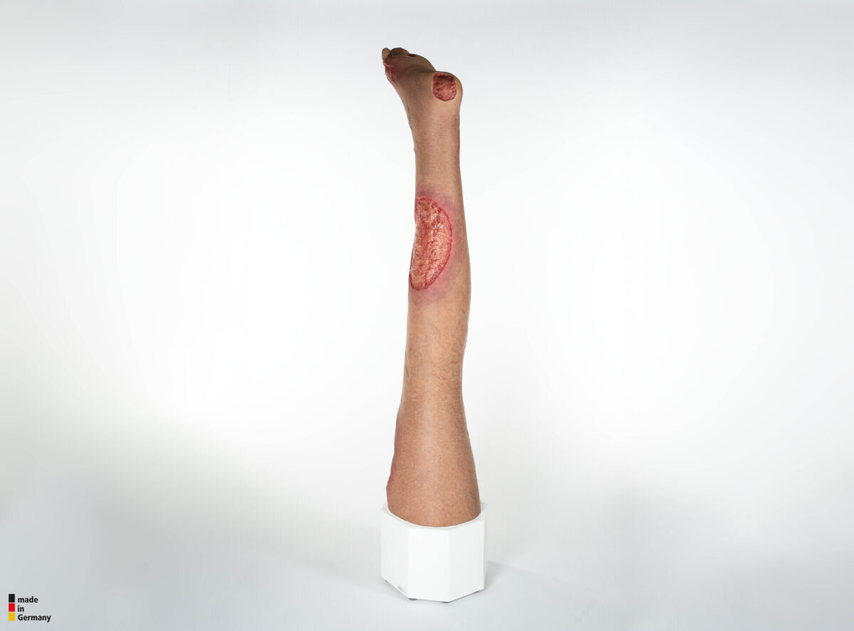 Sockelmodell Bein mit 7 tiefen Wunden