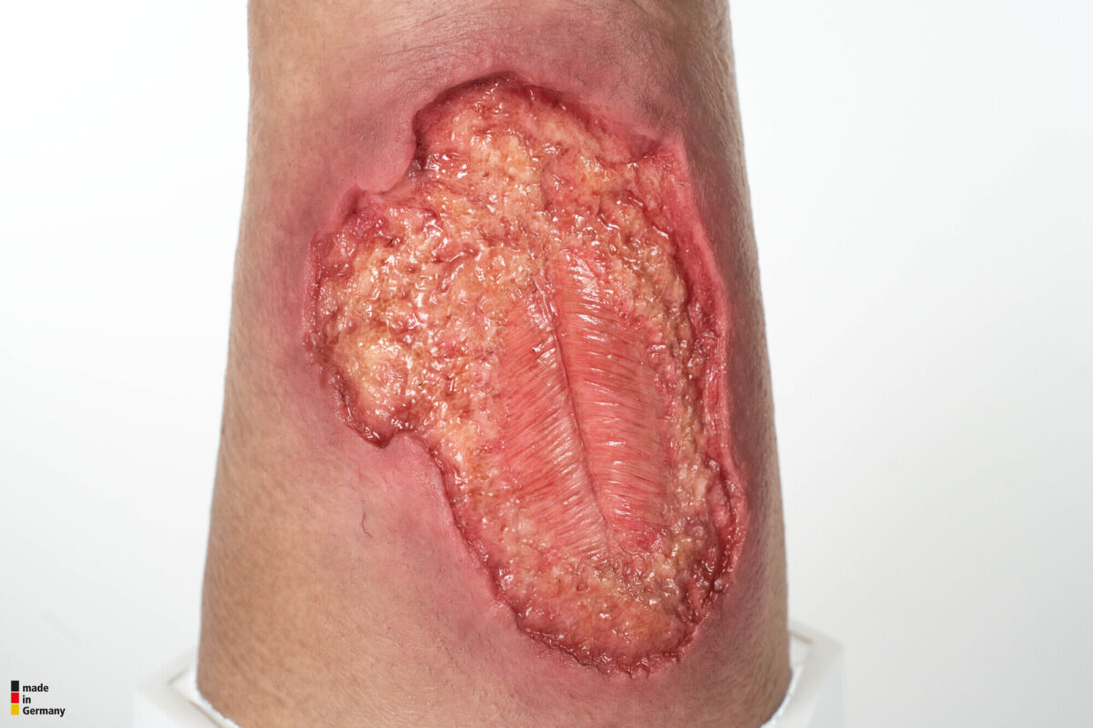 Sockelmodell Bein mit 7 tiefen Wunden