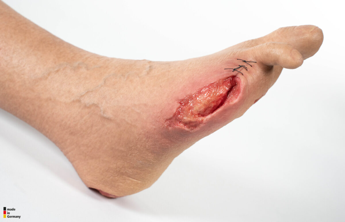 Sockelmodell Bein mit 7 tiefen Wunden