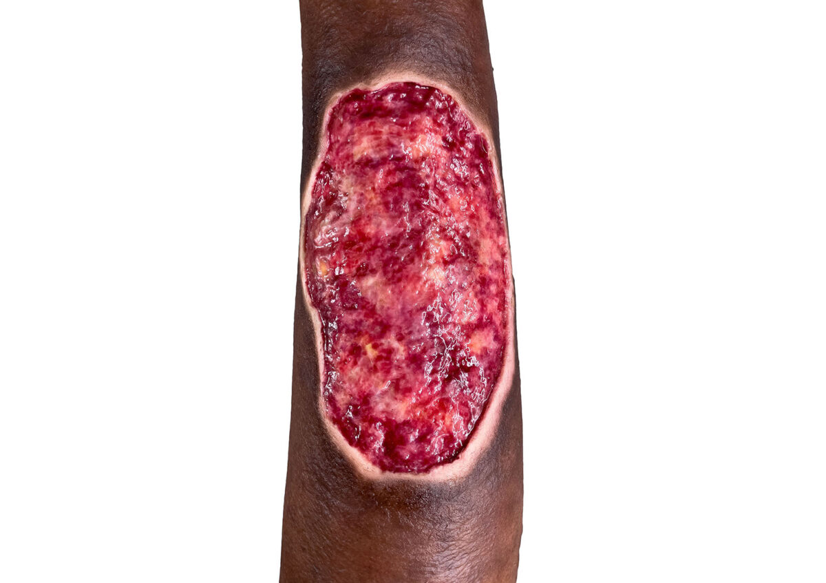 Sockelmodell Bein mit 7 tiefen Wunden