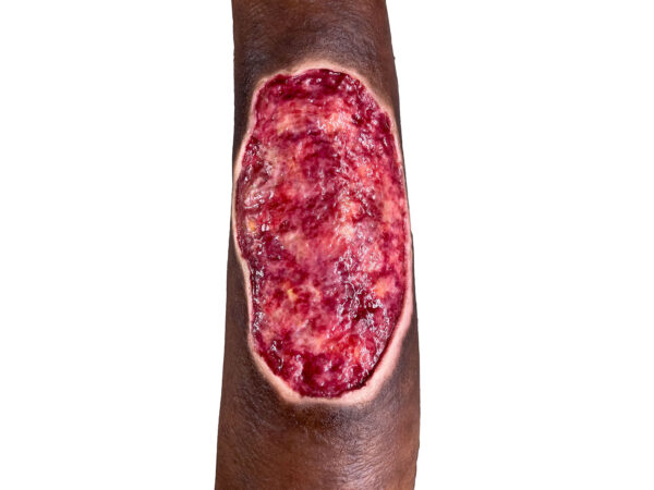 Sockelmodell Bein mit 7 tiefen Wunden – Bild 31