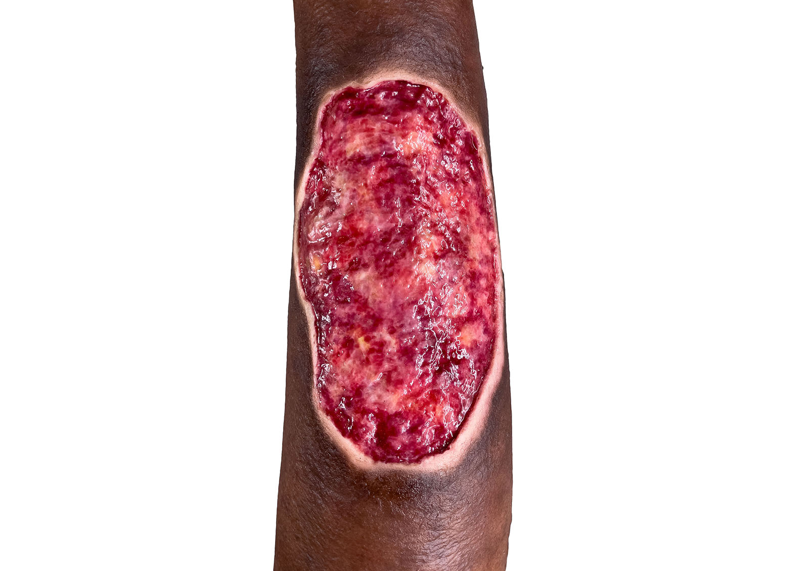 Sockelmodell Bein mit 7 tiefen Wunden – Bild 31