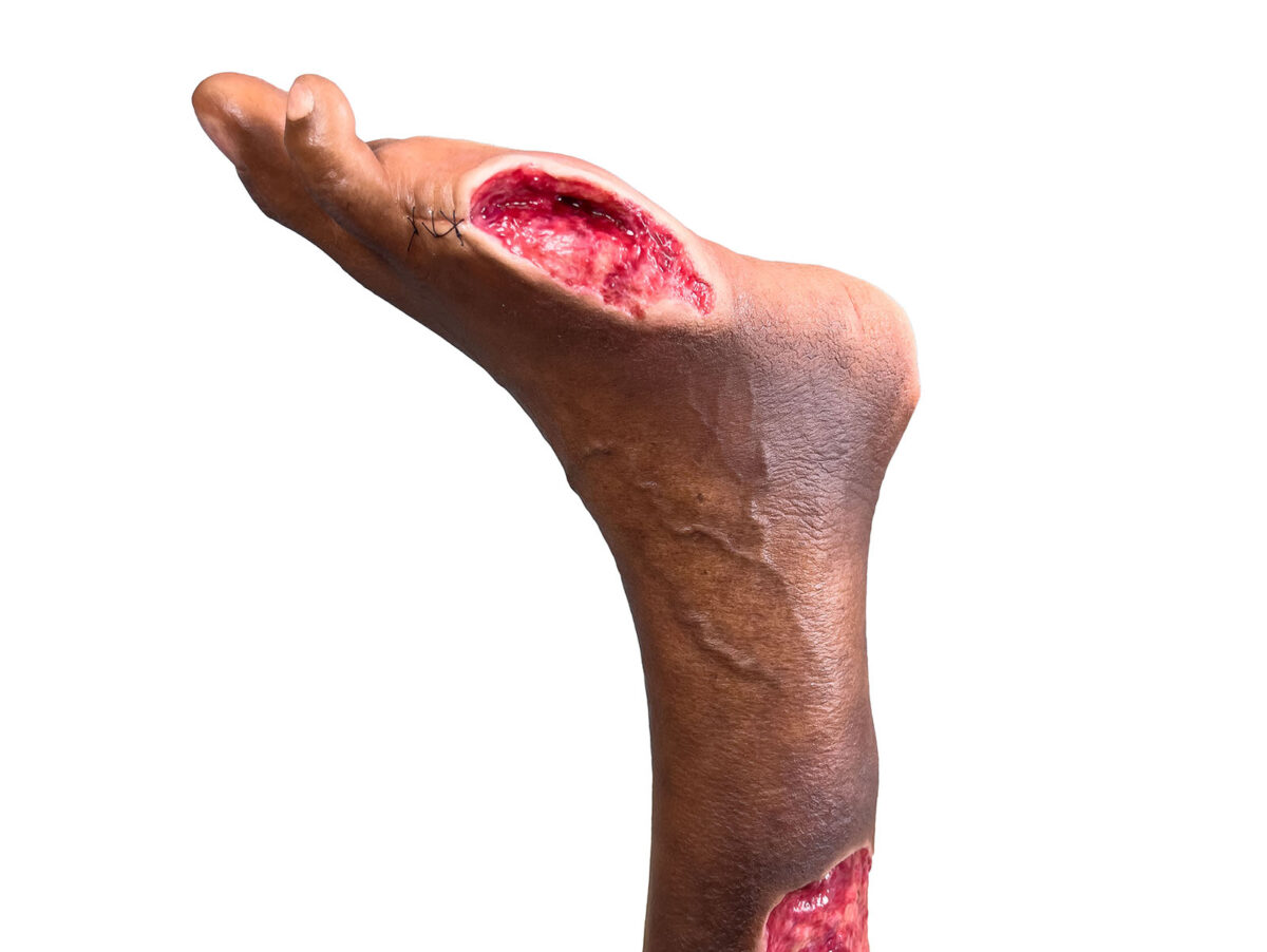 Sockelmodell Bein mit 7 tiefen Wunden