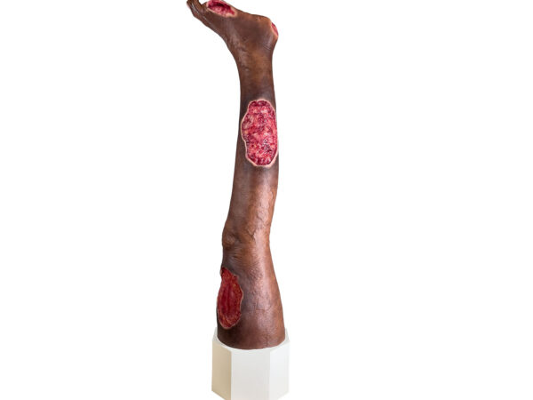 Sockelmodell Bein mit 7 tiefen Wunden – Bild 36