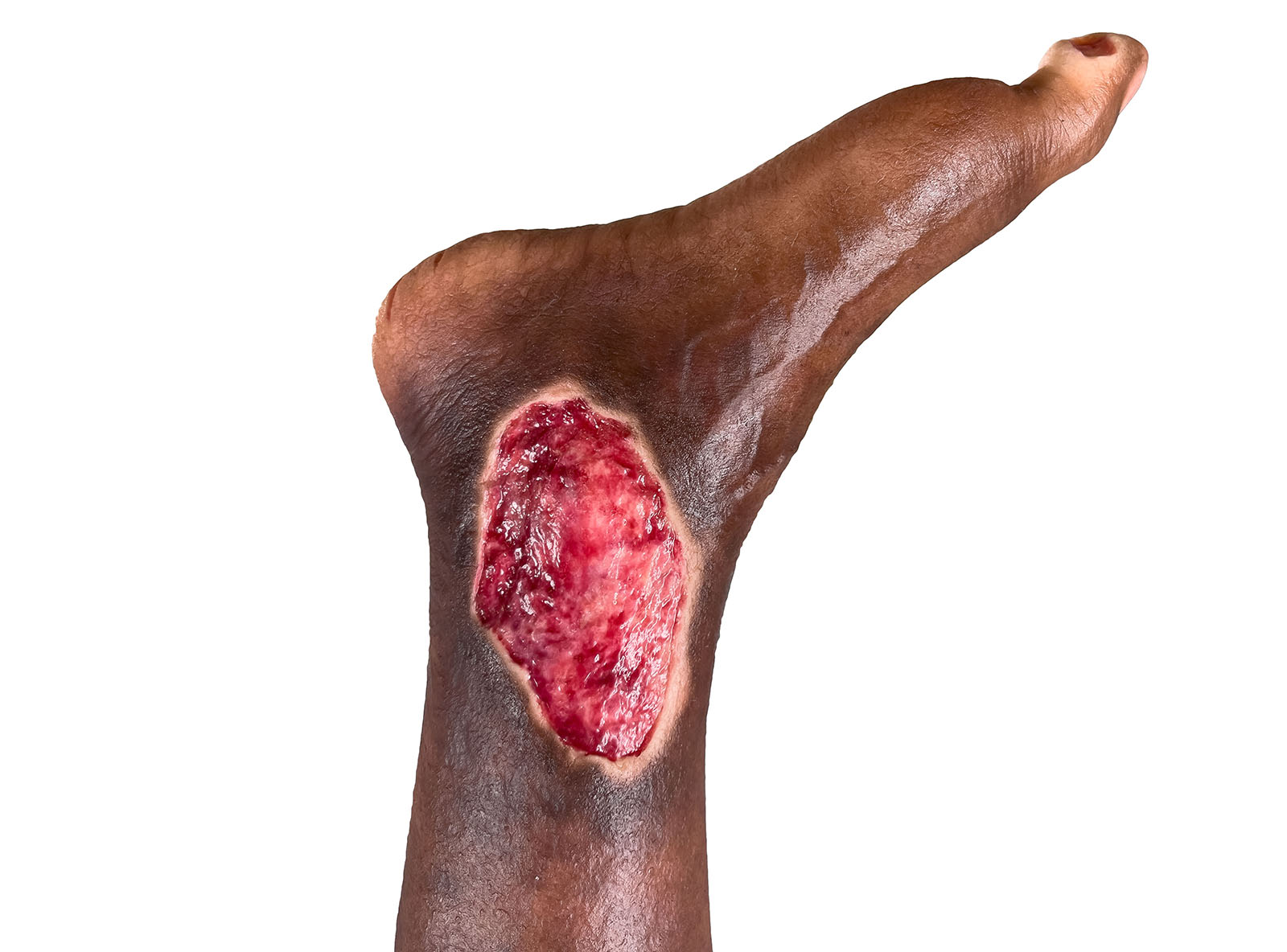 Sockelmodell Bein mit 7 tiefen Wunden – Bild 33