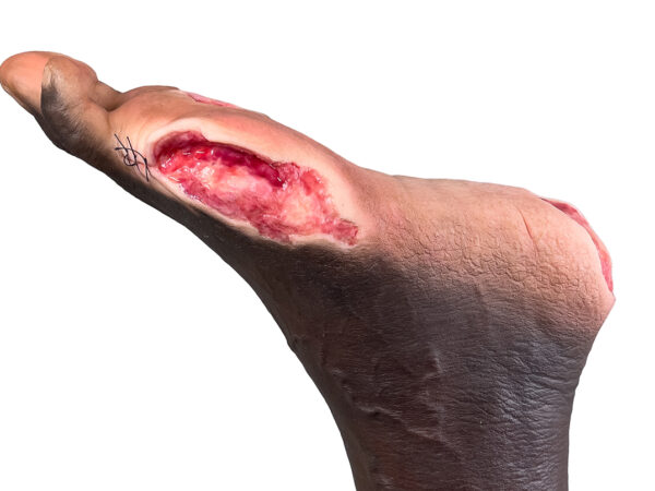 Sockelmodell Bein mit 7 tiefen Wunden – Bild 25