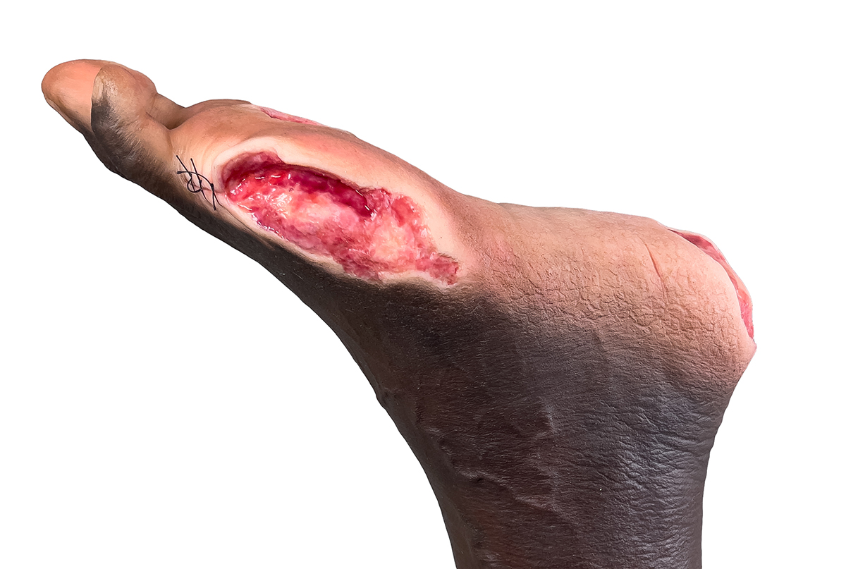 Sockelmodell Bein mit 7 tiefen Wunden