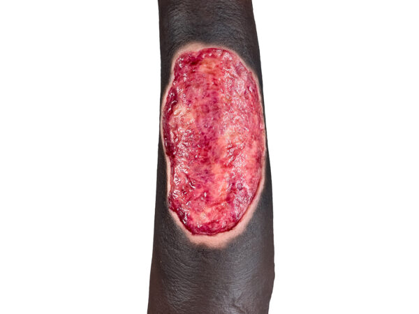 Sockelmodell Bein mit 7 tiefen Wunden – Bild 22