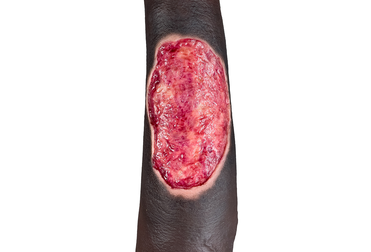 Sockelmodell Bein mit 7 tiefen Wunden