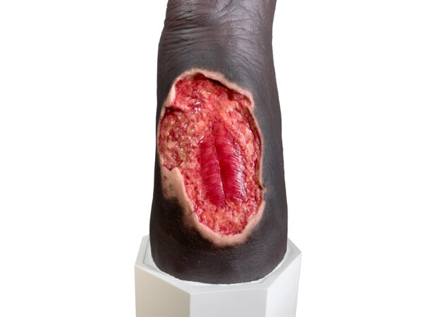 Sockelmodell Bein mit 7 tiefen Wunden – Bild 23