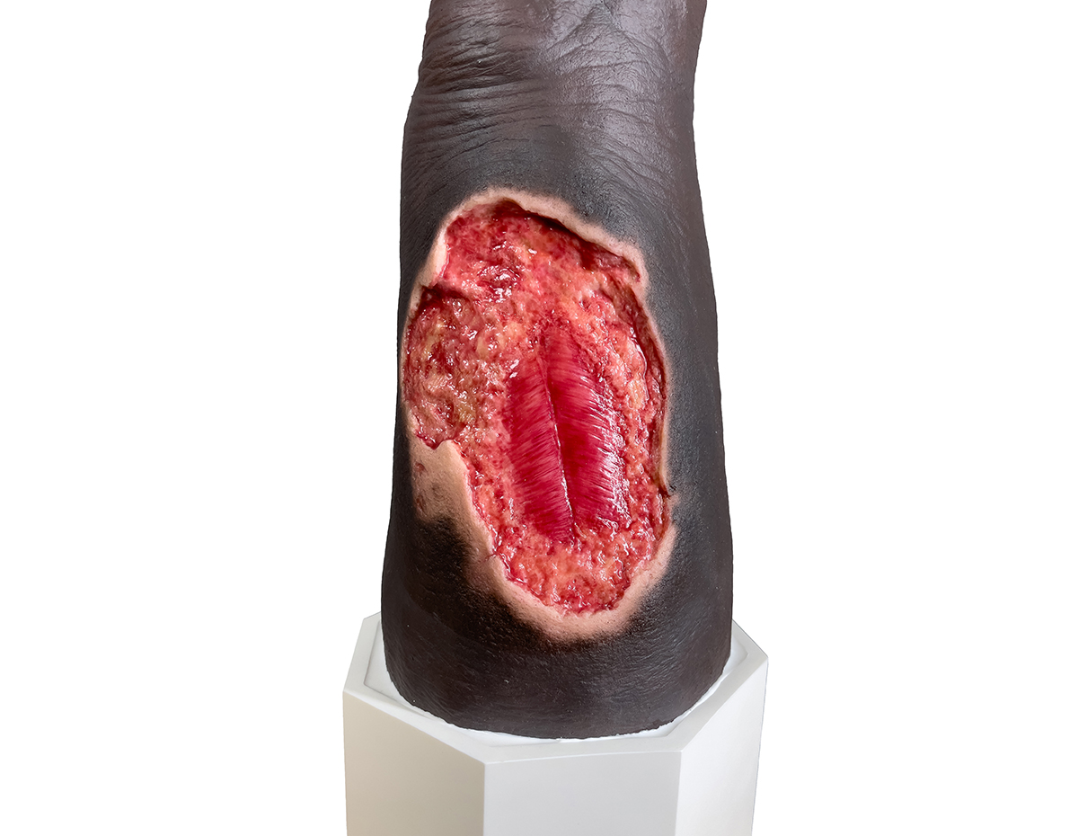 Sockelmodell Bein mit 7 tiefen Wunden