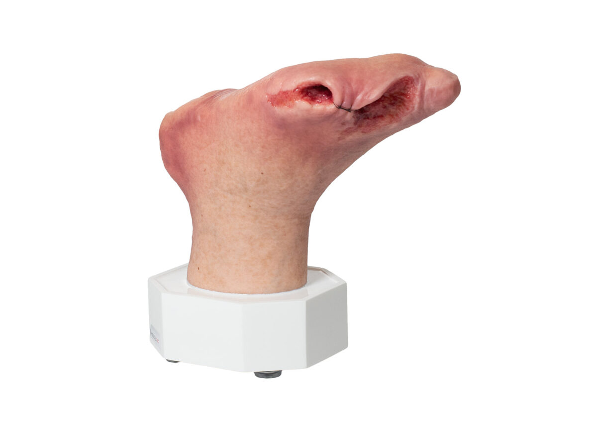 Base Model Diabetic Foot Syndrome with 7 Wounds