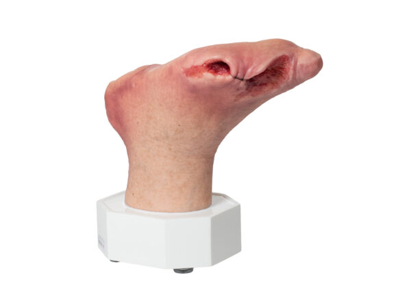 Base Model Diabetic Foot Syndrome with 7 Wounds