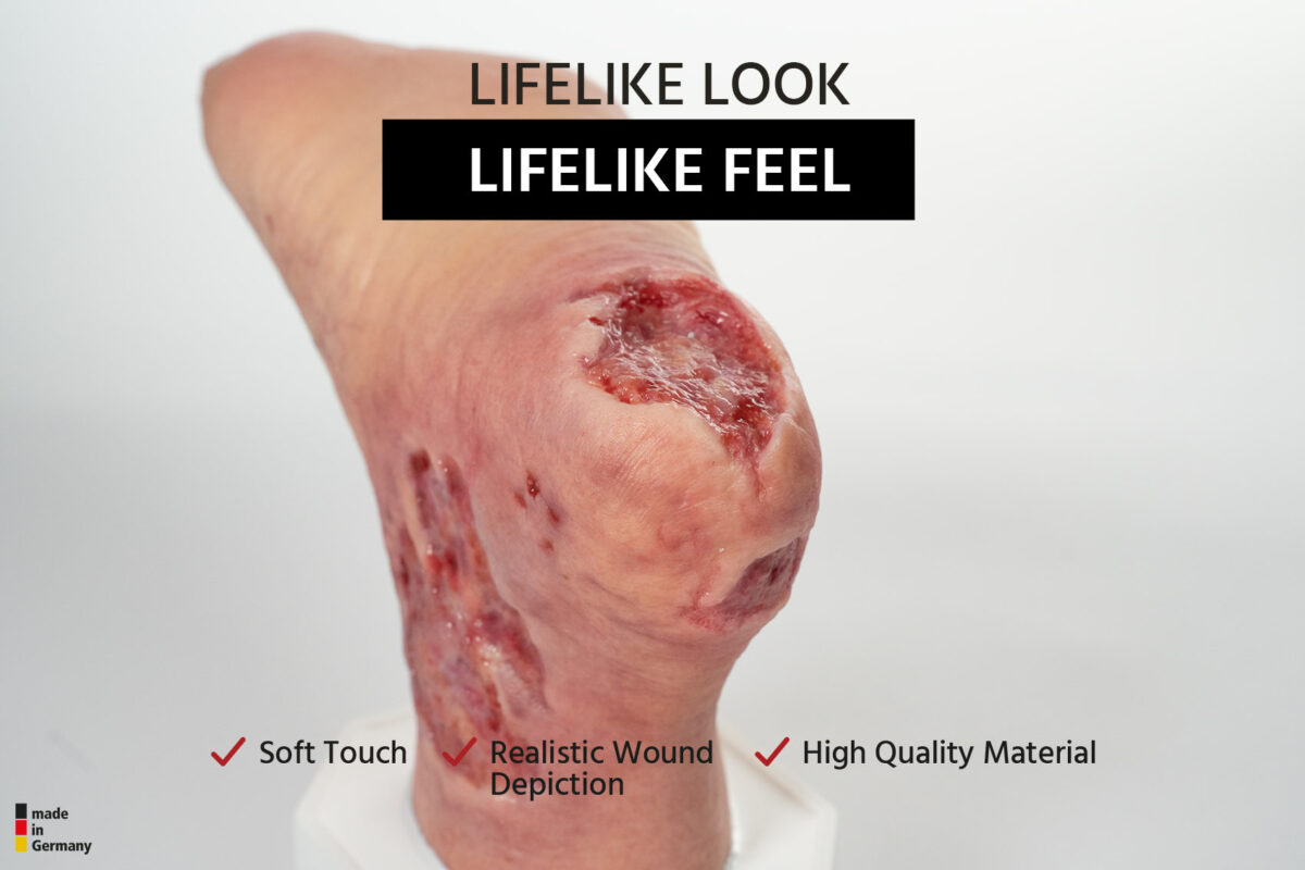 Sockelmodell Diabetisches Fußsyndrom mit 7 Wunden