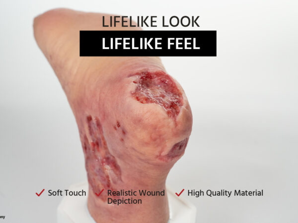 Sockelmodell Diabetisches Fußsyndrom mit 7 Wunden – Bild 5