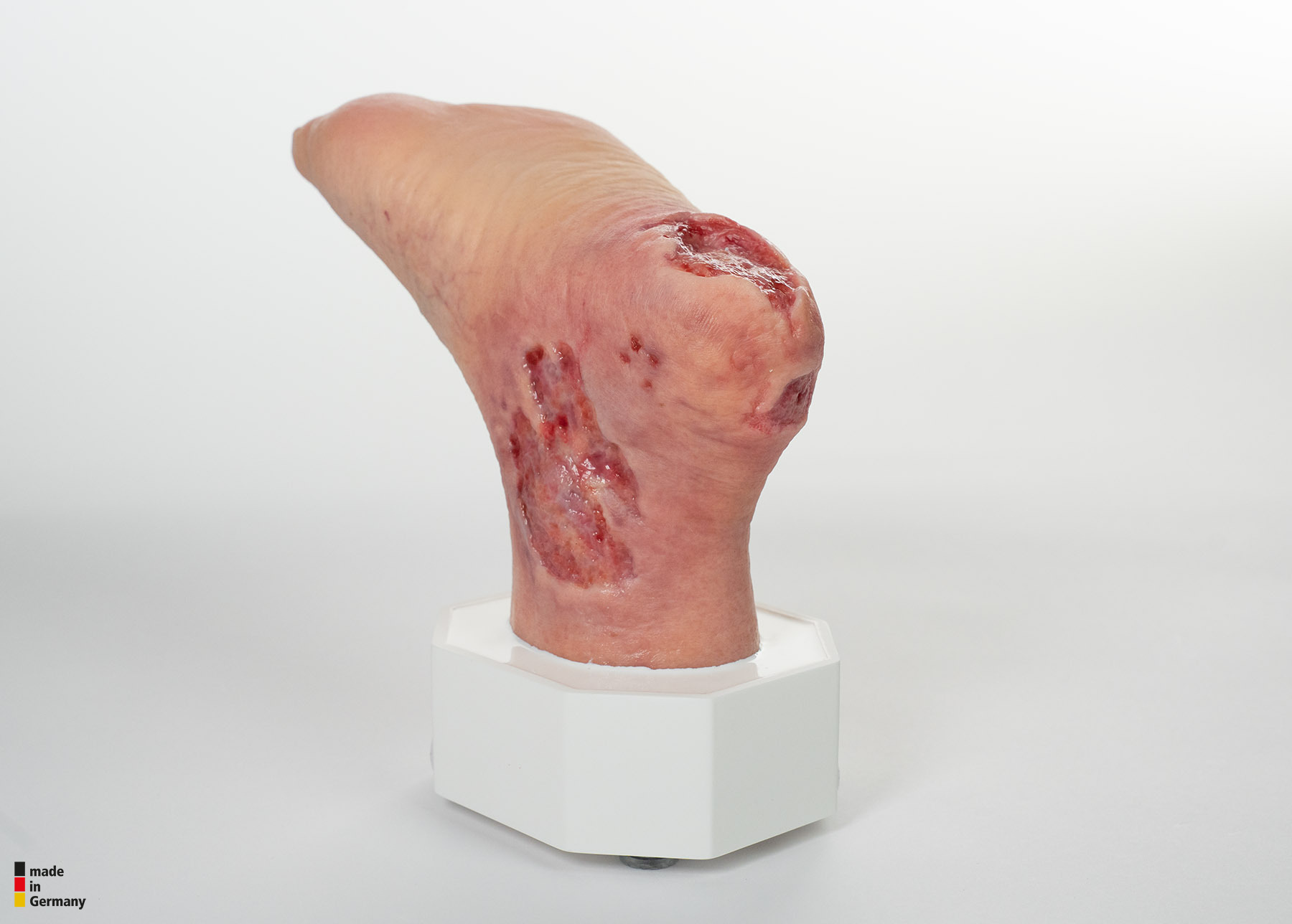 Sockelmodell Diabetisches Fußsyndrom mit 7 Wunden – Bild 4