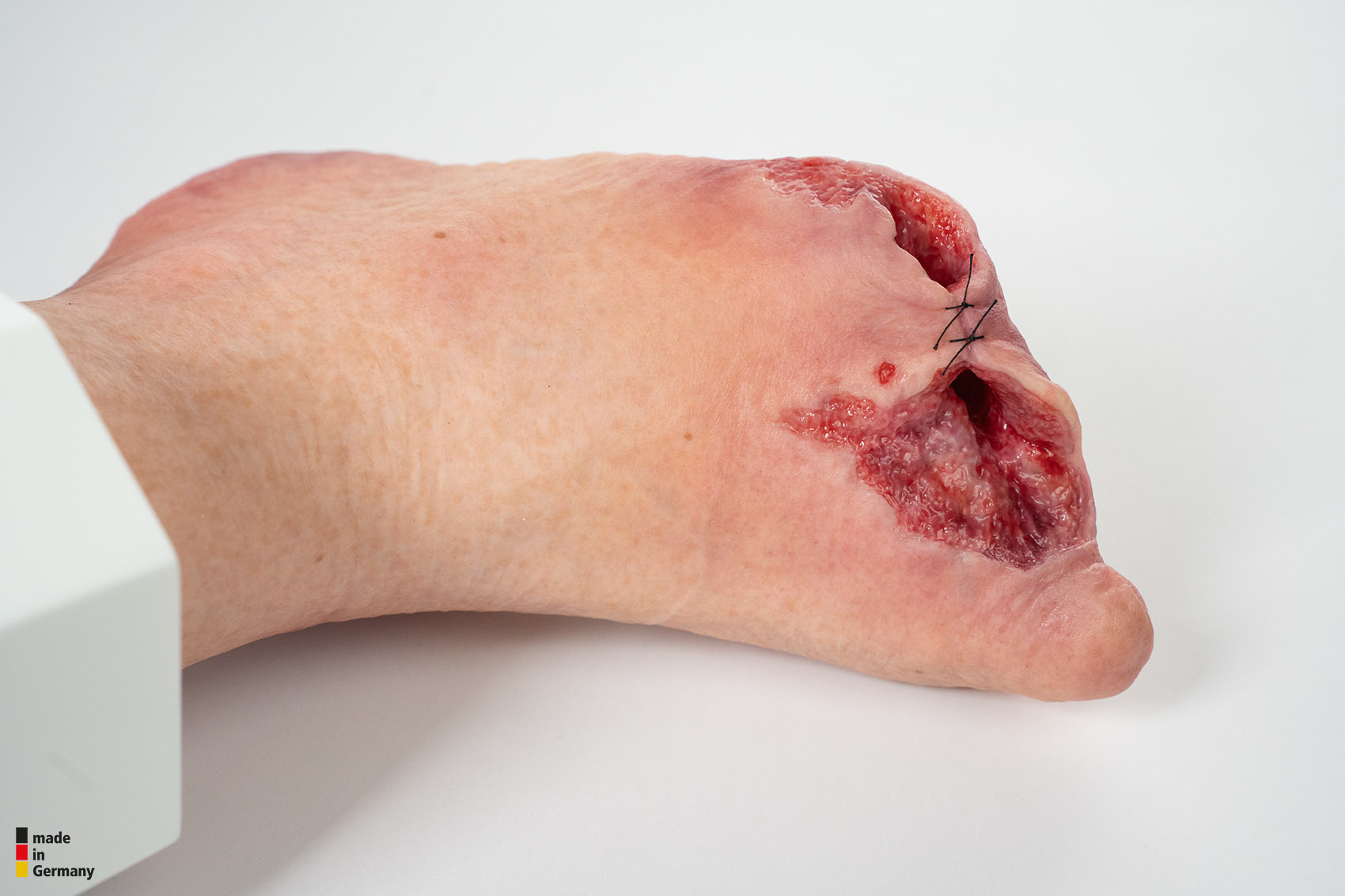 Sockelmodell Diabetisches Fußsyndrom mit 7 Wunden – Bild 7