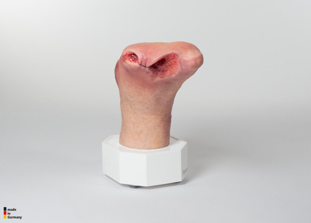 Sockelmodell Diabetisches Fußsyndrom mit 7 Wunden