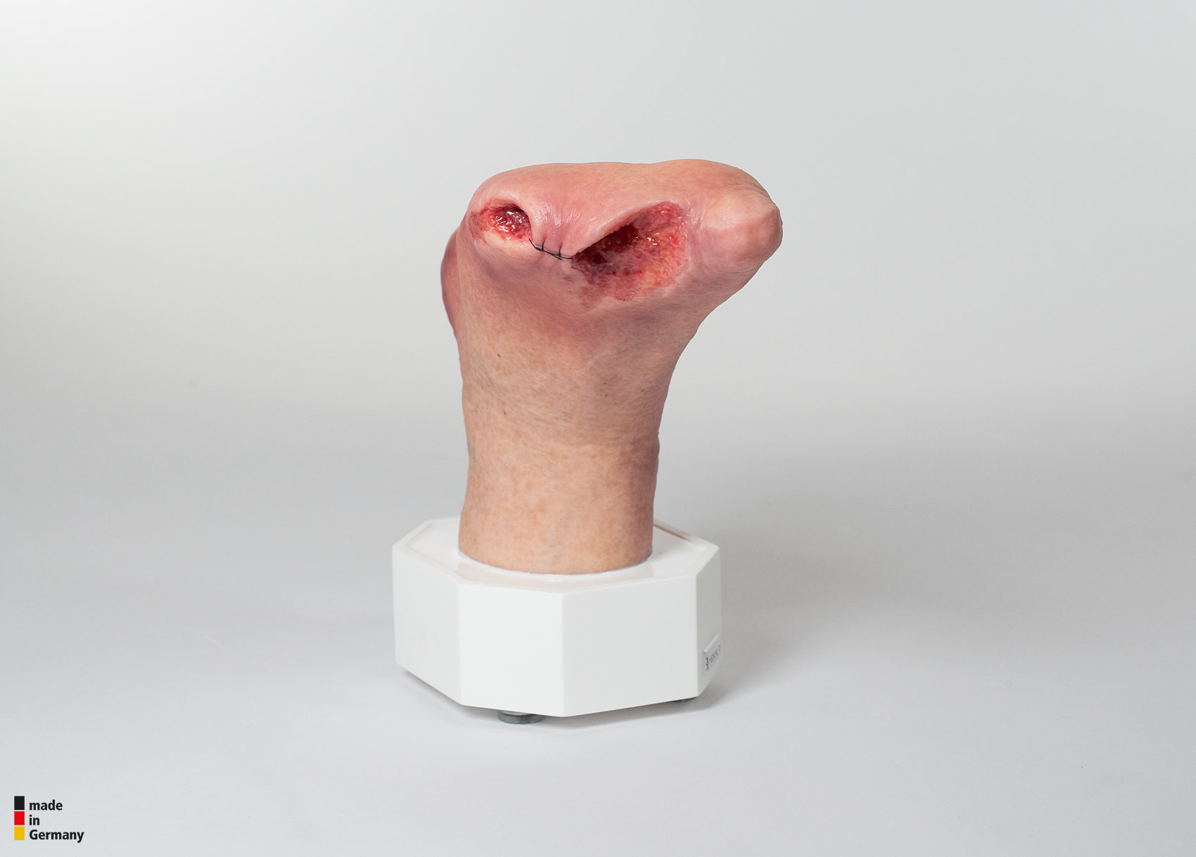 Sockelmodell Diabetisches Fußsyndrom mit 7 Wunden – Bild 3