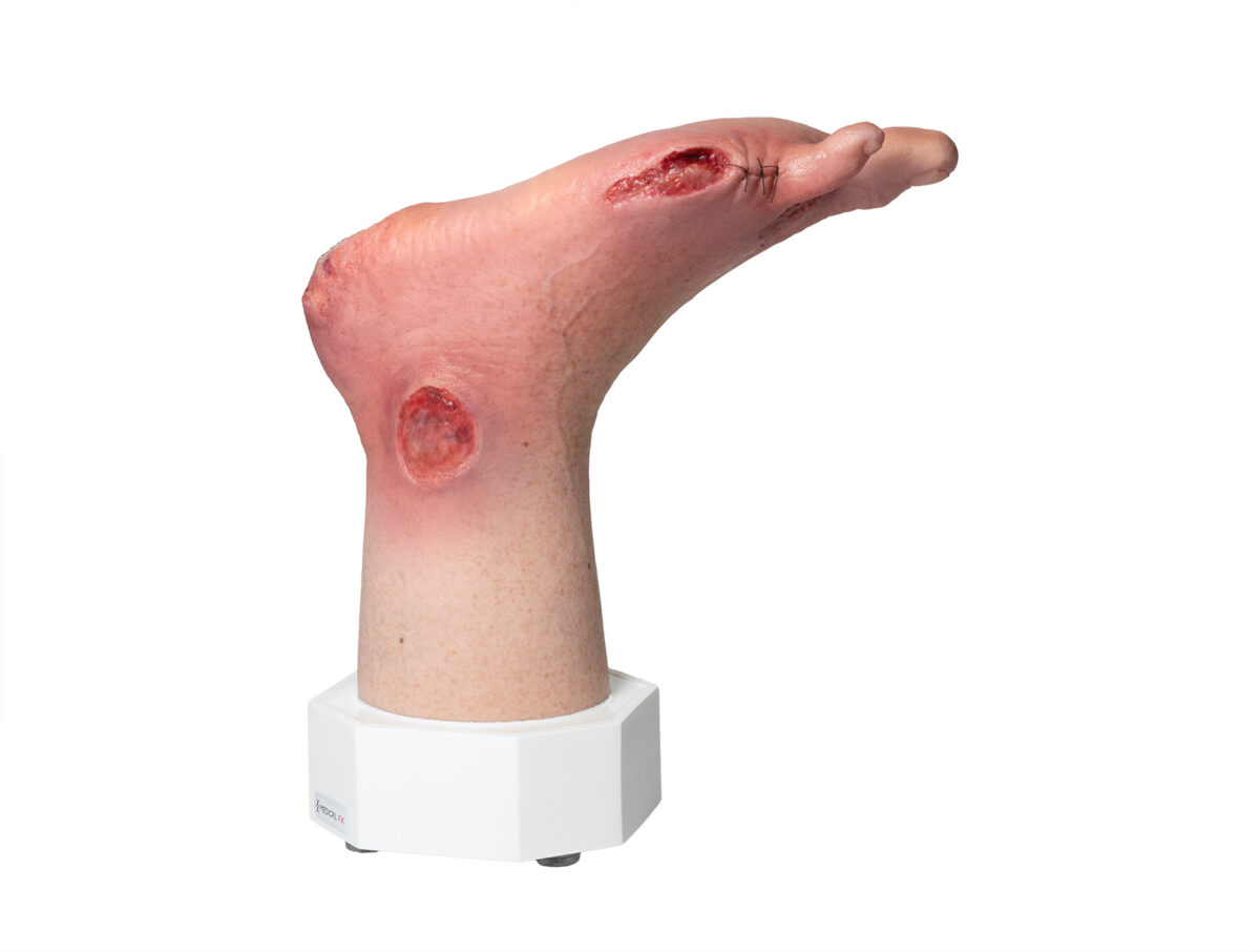 Base Model 6개의 상처가 있는 두 발가락 발