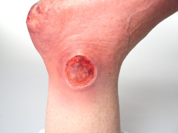 Base Model 6개의 상처가 있는 두 발가락 발 - Image 8