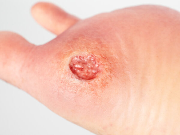 Base Model 6개의 상처가 있는 두 발가락 발 - Image 10