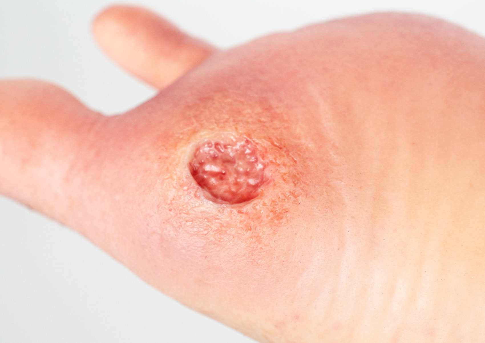 Base Model 6개의 상처가 있는 두 발가락 발 - Image 10