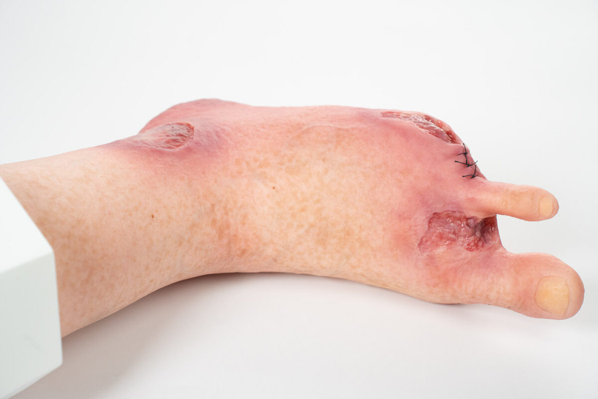 Base Model 6개의 상처가 있는 두 발가락 발