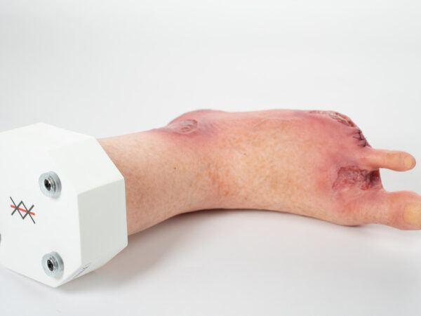 Silikonmodell auf einem Sockel. Fußmodell mit Amputationen