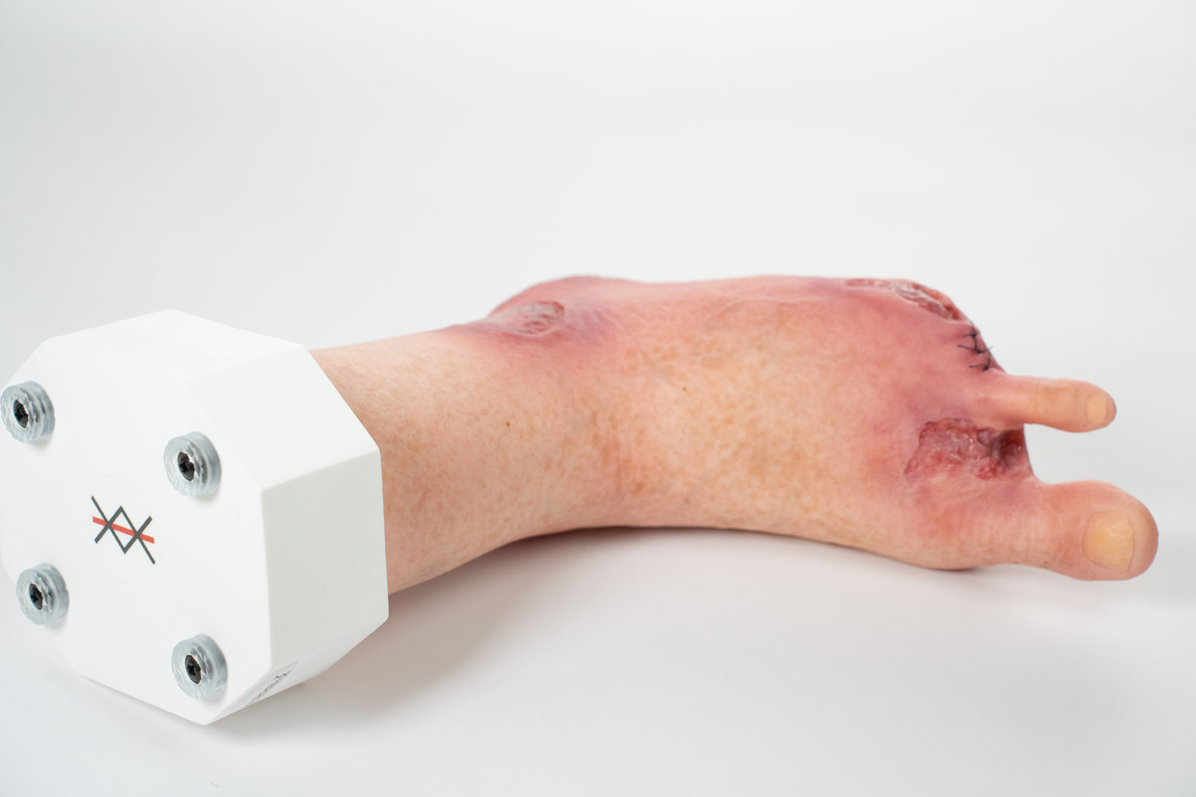 Silikonmodell auf einem Sockel. Fußmodell mit Amputationen