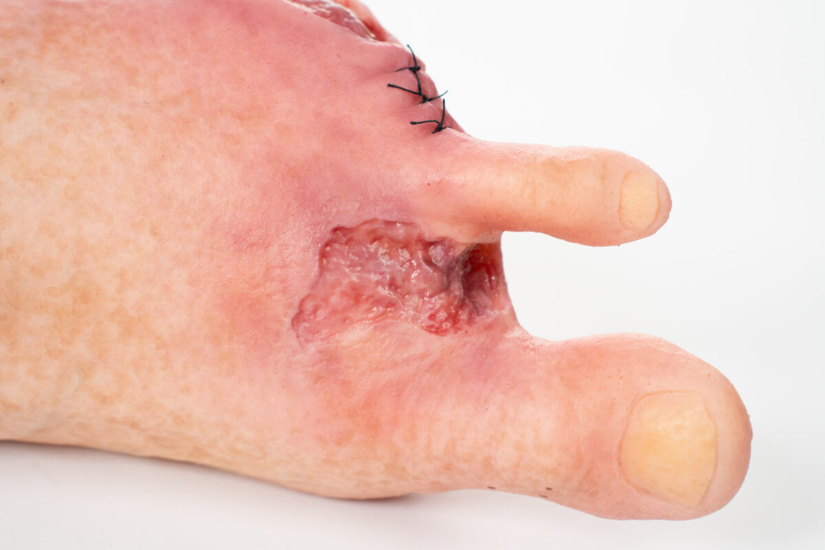 Base Model 6개의 상처가 있는 두 발가락 발