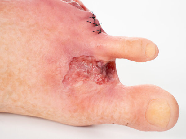 Base Model 6개의 상처가 있는 두 발가락 발 - Image 11