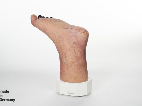 Sockelmodell Nekrotischer Fuß – Bild 5