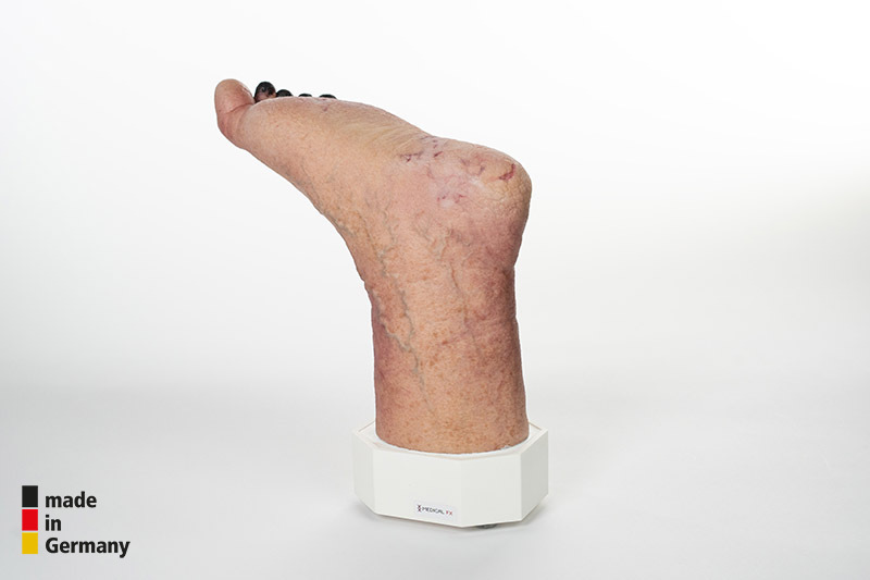 Sockelmodell Nekrotischer Fuß