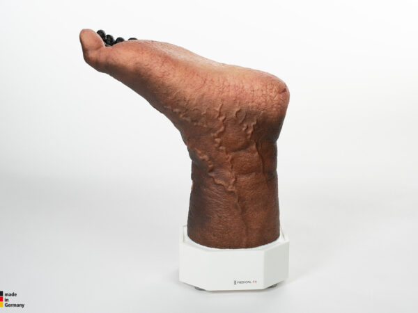 Sockelmodell Nekrotischer Fuß – Bild 11