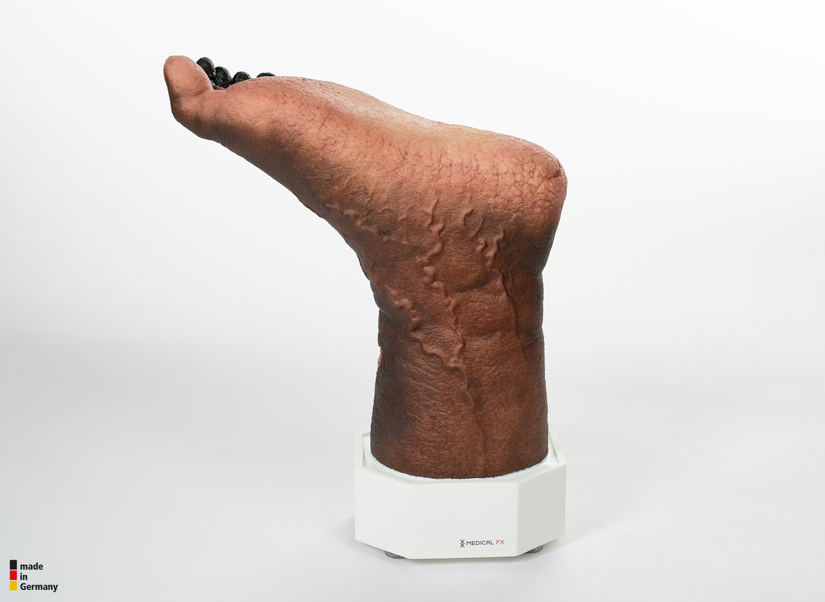 Sockelmodell Nekrotischer Fuß – Bild 11