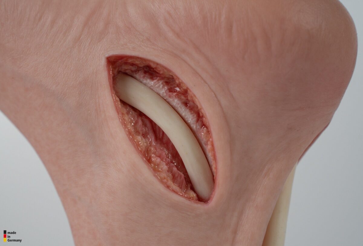 Modelo base Pie con 2 tendones expuestos, tendón de Aquiles, tendón tibial posterior