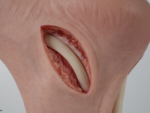 Modelo base Pie con 2 tendones expuestos, tendón de Aquiles, tendón tibial posterior - Image 14