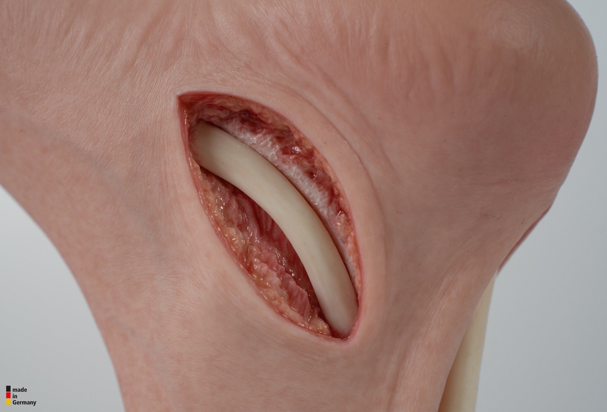 Modelo base Pie con 2 tendones expuestos, tendón de Aquiles, tendón tibial posterior - Image 14
