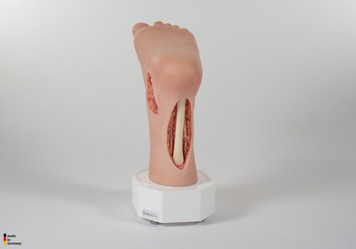 Modelo base Pie con 2 tendones expuestos, tendón de Aquiles, tendón tibial posterior