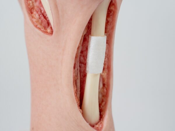 Modelo base Pie con 2 tendones expuestos, tendón de Aquiles, tendón tibial posterior - Image 15