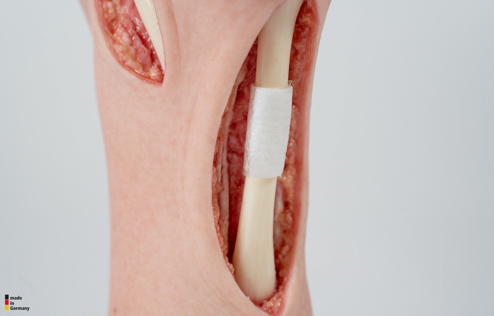 Modelo base Pie con 2 tendones expuestos, tendón de Aquiles, tendón tibial posterior - Image 15