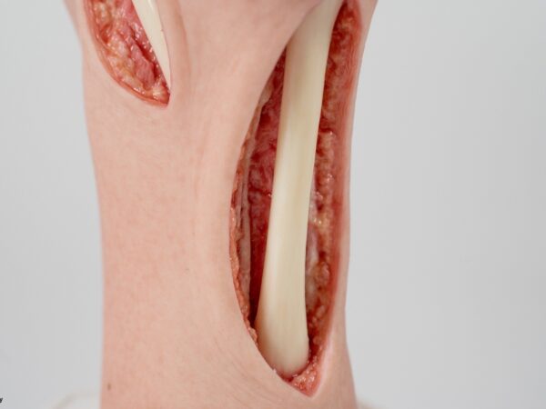 Modelo base Pie con 2 tendones expuestos, tendón de Aquiles, tendón tibial posterior - Image 2