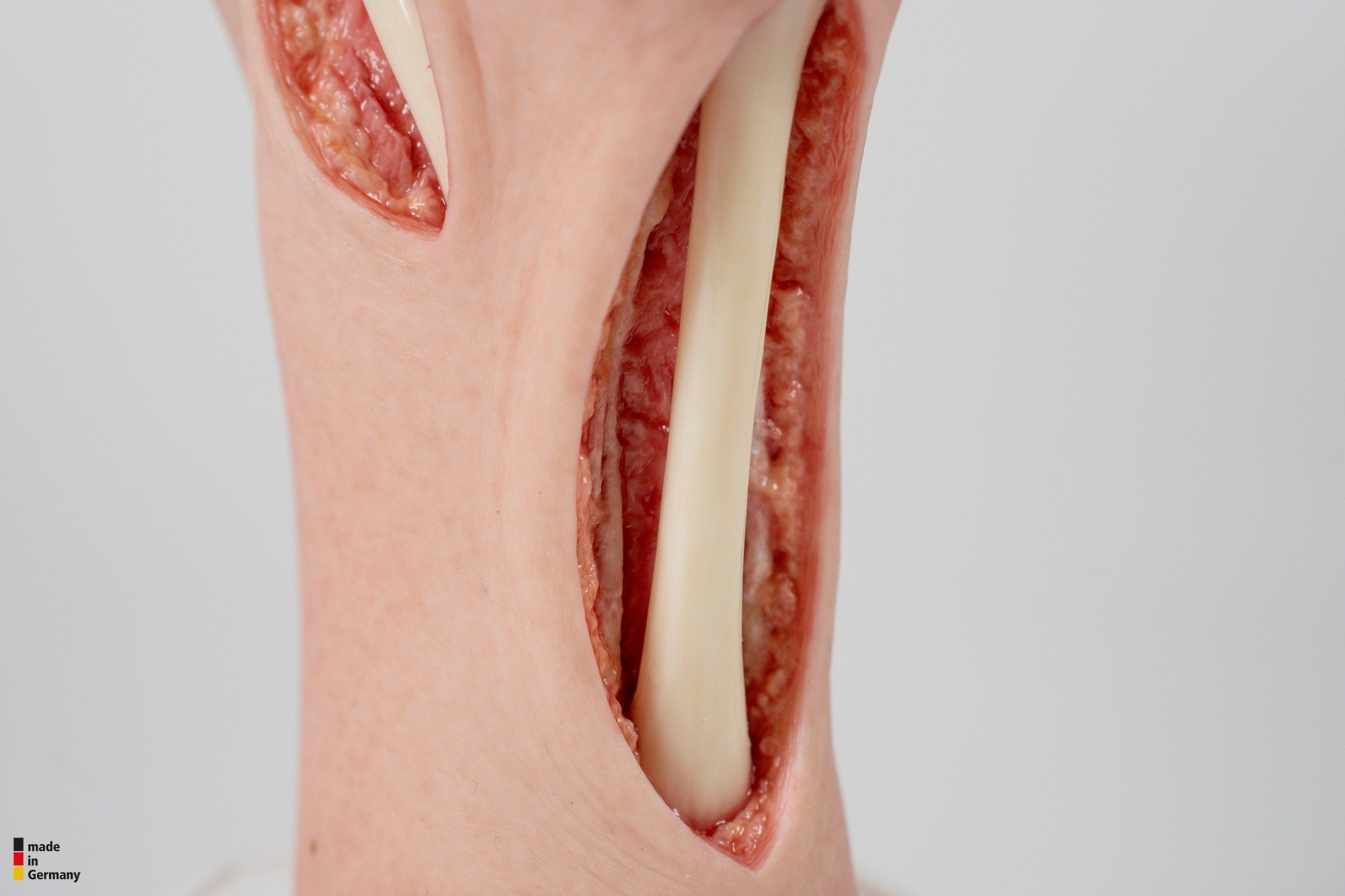 Modelo base Pie con 2 tendones expuestos, tendón de Aquiles, tendón tibial posterior - Image 2