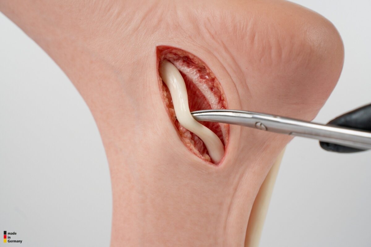 Modelo base Pie con 2 tendones expuestos, tendón de Aquiles, tendón tibial posterior
