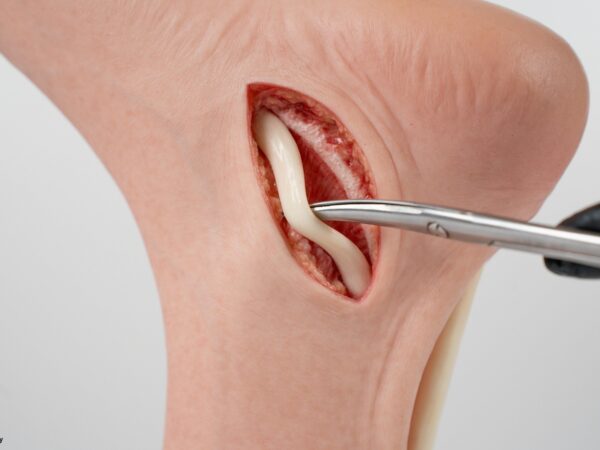 Modelo base Pie con 2 tendones expuestos, tendón de Aquiles, tendón tibial posterior - Image 5