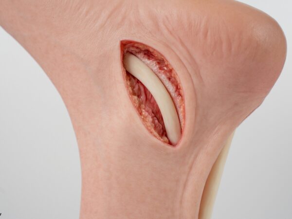 Modelo base Pie con 2 tendones expuestos, tendón de Aquiles, tendón tibial posterior - Image 4