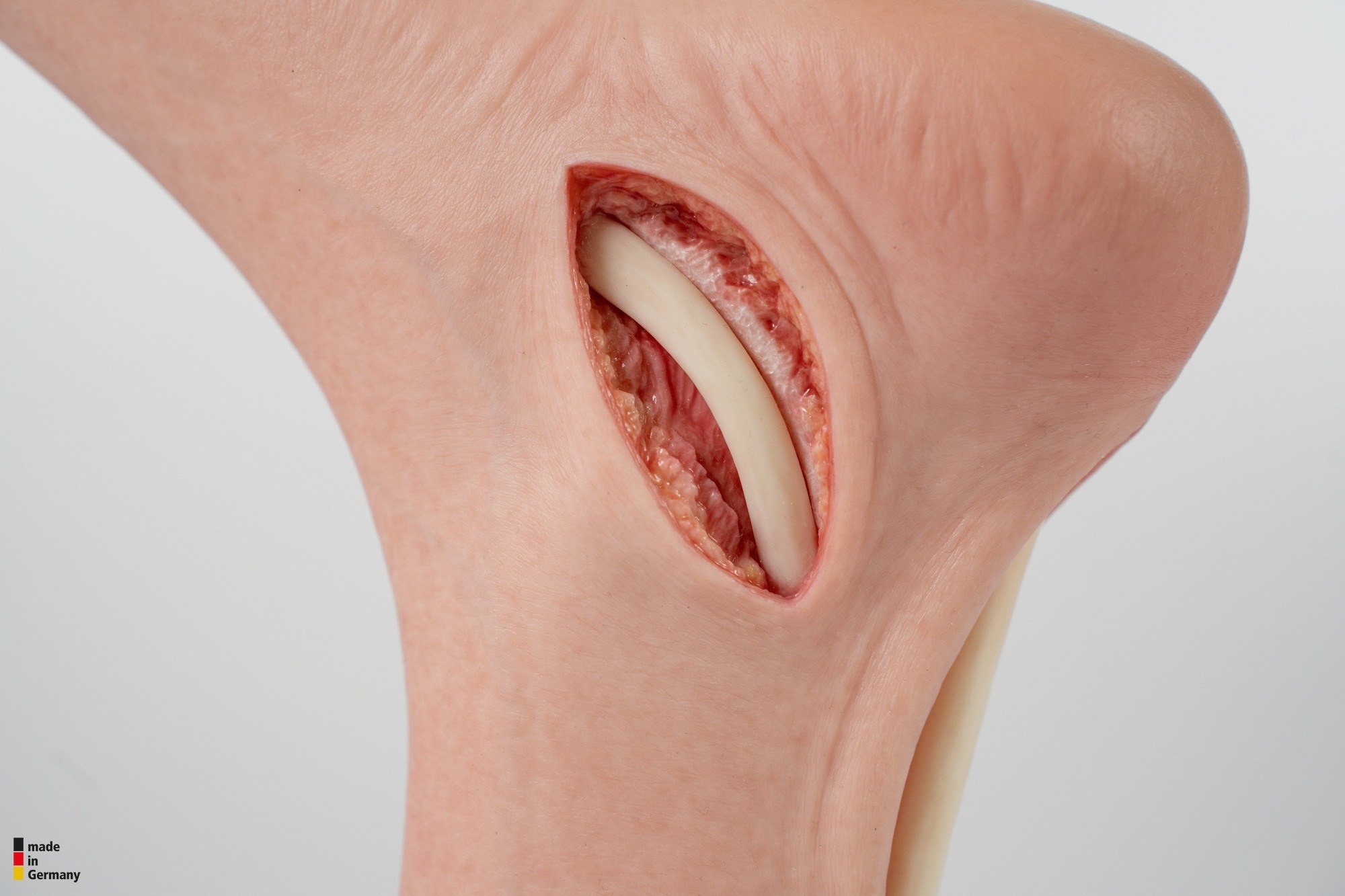 Modelo base Pie con 2 tendones expuestos, tendón de Aquiles, tendón tibial posterior - Image 4
