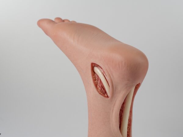Modelo base Pie con 2 tendones expuestos, tendón de Aquiles, tendón tibial posterior - Image 17
